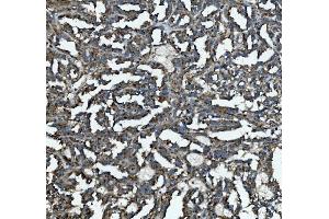 IHC analysis of GLB1/Beta-galactosidase using anti-GLB1/Beta-galactosidase antibody (ABIN7601806). (GLB1 抗体  (AA 46-655))