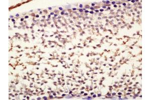 Immunohistochemistry (Paraffin-embedded Sections) (IHC (p)) image for anti-Nanog Homeobox (NANOG) (AA 101-200) antibody (ABIN2177828)