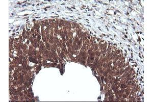 Image no. 6 for anti-Cancer/testis Antigen 1B (CTAG1B) antibody (ABIN1499895) (CTAG1B 抗体)