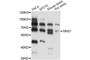 Western blot analysis of extracts of various cell lines, using MNS1 antibody (ABIN6293805) at 1:3000 dilution. (MNS1 抗体)