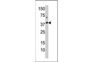 Western blot analysis of RCL1 polyclonal antibody  in A-375 cell line lysate (35 ug/lane). (RCL1 抗体  (N-Term))