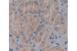 IHC-P analysis of Human Tissue, with DAB staining. (PAPPA2 抗体  (AA 888-1093))