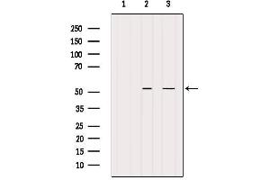 Western blot analysis of extracts from various samples, using BAGE5 Antibody. (BAGE5 抗体)