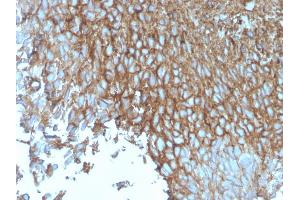 Immunohistochemistry (IHC) image for anti-Solute Carrier Family 2 (Facilitated Glucose Transporter), Member 1 (SLC2A1) (AA 203-305) antibody (ABIN6940596)