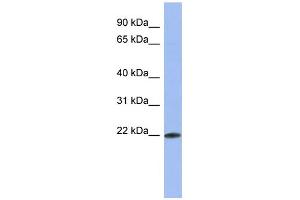 WB Suggested Anti-RBM38 Antibody Titration:  0. (RBM38 抗体  (Middle Region))