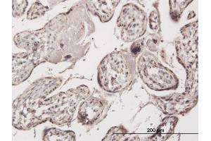 Immunoperoxidase of purified MaxPab antibody to ZNF584 on formalin-fixed paraffin-embedded human placenta. (ZNF584 抗体  (AA 1-421))