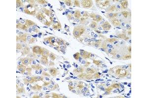 Immunohistochemistry of paraffin-embedded Human stomach using SPATA4 Polyclonal Antibody at dilution of 1:100 (40x lens). (SPATA4 抗体)