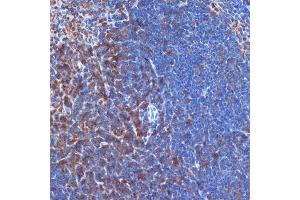 Immunohistochemistry of paraffin-embedded mouse spleen using PI3 Kinase p110 delta Rabbit mAb (ABIN7269326) at dilution of 1:100 (40x lens). (PIK3CD 抗体)