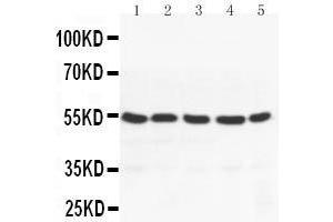 Anti-PPAR gamma antibody, Western blotting Lane 1: MM453 Cell Lysate Lane 2: MM231 Cell Lysate Lane 3: HELA Cell Lysate Lane 4: JURKAT Cell Lysate Lane 5:  Cell Lysate (PPARG 抗体  (N-Term))