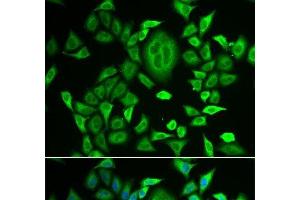 Immunofluorescence analysis of MCF-7 cells using RBP3 Polyclonal Antibody (RBP3 抗体)