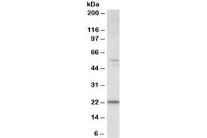 Western blot testing of human kidney lysate with MAD4 antibody at 0. (MXD4 抗体)