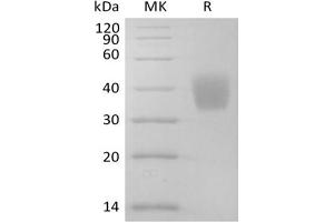 Western Blotting (WB) image for Interleukin 4 Receptor (IL4R) protein (His tag) (ABIN7320921)