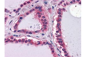 Immunohistochemical analysis of paraffin-embedded human Thyroid tissues using LAMB1 mouse mAb (Laminin beta 1 抗体  (AA 31-270))