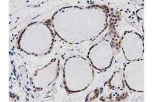 Immunohistochemical staining of paraffin-embedded Human Kidney tissue using anti-DNAJA2 mouse monoclonal antibody. (DNAJA2 抗体)