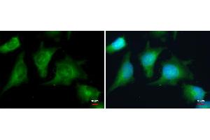 ICC/IF Image PRKAR2A antibody detects PRKAR2A protein at cytoplasm by immunofluorescent analysis. (PRKAR2A 抗体  (Center))