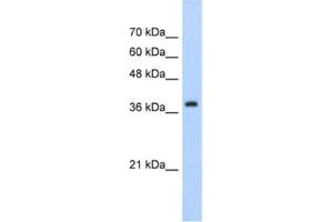 Western Blotting (WB) image for anti-Chromobox Homolog 6 (CBX6) antibody (ABIN2461847) (CBX6 抗体)