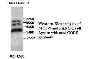 Image no. 2 for anti-Coatomer Protein Complex, Subunit epsilon (COPE) antibody (ABIN791222) (COPE 抗体)