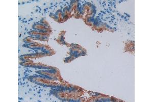 Used in DAB staining on fromalin fixed paraffin- embedded bronchus tissue (VPREB1 抗体  (AA 43-128))