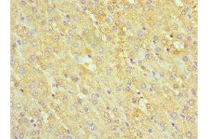Immunohistochemistry of paraffin-embedded human liver tissue using ABIN7142463 at dilution of 1:100 (ABAT 抗体  (AA 29-300))