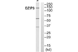 Immunohistochemistry analysis of paraffin-embedded human breast carcinoma tissue, using DZIP3 antibody. (DZIP3 抗体)