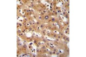 Formalin fixed and paraffin embedded human liver tissue reacted with GGCX Antibody (Center) followed by peroxidase conjugation of the secondary antibody and DAB staining. (GGCX 抗体  (Middle Region))