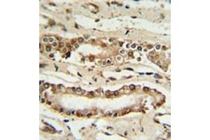 Immunohistochemistry analysis in formalin fixed and paraffin embedded lung tissue reacted with FOXP1 Antibody (C-term) followed by peroxidase conjugation of the secondary antibody and DAB staining. (FOXP1 抗体  (C-Term))