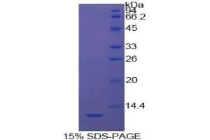 SDS-PAGE analysis of Cow Caspase 4 Protein. (Caspase 4 蛋白)