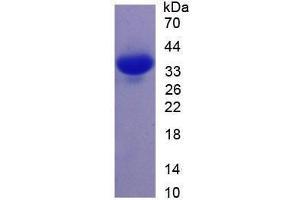 SDS-PAGE analysis of Mouse Annexin V Protein. (Annexin V 蛋白)