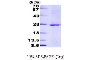 Jun Dimerization Protein 2 (JDP2) (AA 1-163) protein (His tag)