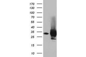 Western Blotting (WB) image for anti-Pyrroline-5-Carboxylate Reductase Family, Member 2 (PYCR2) antibody (ABIN1499982) (PYCR2 抗体)