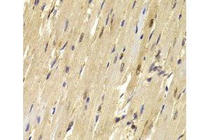 Immunohistochemistry of paraffin-embedded Mouse heart using TOPBP1 Polyclonal Antibody at dilution of 1:100 (40x lens). (TOPBP1 抗体)