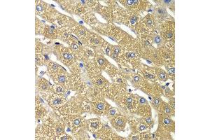 Immunohistochemistry of paraffin-embedded human liver injury using TMED10 antibody at dilution of 1:100 (x40 lens). (TMED10 抗体)