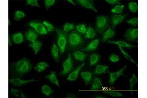 Immunofluorescence of monoclonal antibody to MAPK12 on HeLa cell. (MAPK12 抗体  (AA 251-367))
