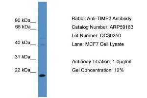 WB Suggested Anti-TIMP3  Antibody Titration: 0. (TIMP3 抗体  (N-Term))