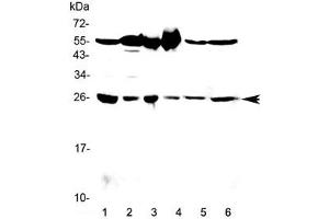 Western blot testing of 1) rat testis, 2) rat brain, 3) mouse testis, 4) mouse brain, 5) human HeLa and 6) human MCF7 lysate with GSTM3 antibody at 0. (GSTM3 抗体)