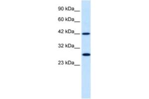 Western Blotting (WB) image for anti-Proteasome (Prosome, Macropain) 26S Subunit, Non-ATPase, 4 (Psmd4) antibody (ABIN2460431) (PSMD4/ASF 抗体)