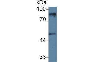 Detection of PKCe in Mouse Cerebrum lysate using Monoclonal Antibody to Protein Kinase C Epsilon (PKCe) (PKC epsilon 抗体  (AA 403-672))