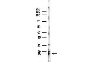 Western blot analysis of lysates from F10-LUC cells(starvation,24h treatment), using Histone H2B Antibody at 1/1000 dilution.