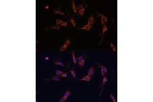 Immunofluorescence analysis of C6 cells using IQG Polyclonal Antibody (ABIN7268020) at dilution of 1:100 (40x lens). (IQGAP1 抗体  (AA 500-750))