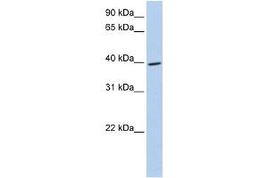 WB Suggested Anti-MEIS3 Antibody Titration:  0. (MEIS3 抗体  (Middle Region))