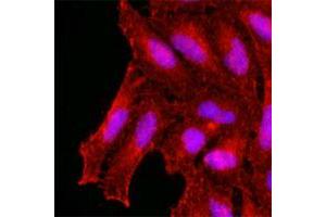 Immunofluorescence of human HeLa cells stained with KCTD15 monoclonal antibody, clone AT4C3  (1 : 500) with Texas Red (Red). (KCTD15 抗体  (AA 1-234))