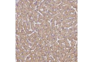 Immunohistochemical staining of human liver with UTP23 polyclonal antibody  shows moderate cytoplasmic positivity in hepatocytes at 1:50-1:200 dilution. (UTP23 抗体)