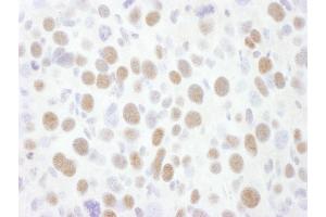 Immunohistochemistry (IHC) image for anti-Cyclin-Dependent Kinase 9 (CDK9) (AA 322-372) antibody (ABIN7453621)