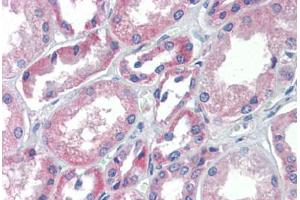 Human Kidney (formalin-fixed, paraffin-embedded) stained with TRIM68 antibody ABIN462217 followed by biotinylated goat anti-rabbit IgG secondary antibody ABIN481713, alkaline phosphatase-streptavidin and chromogen. (TRIM68 抗体  (AA 395-444))