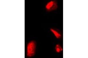 Immunofluorescent analysis of RPS5 staining in Hela cells. (RPS5 抗体)
