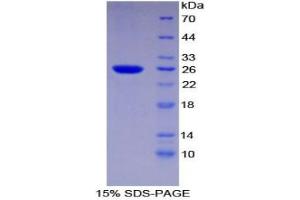 SDS-PAGE analysis of Mouse Transportin 1 Protein. (Transportin 1 Protein (TNPO1))