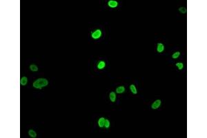 Immunofluorescent analysis of MCF-7 cells (sodium butyrate, 30 mM, 4h) using ABIN7139163 at dilution of 1:100 and Alexa Fluor 488-congugated AffiniPure Goat Anti-Rabbit IgG(H+L) (HIST1H1E 抗体  (acLys16))