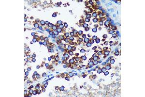 Immunohistochemistry of paraffin-embedded Mouse testis using R Rabbit pAb (ABIN7269785) at dilution of 1:100 (40x lens). (RABGAP1 抗体  (AA 830-1069))
