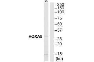 Western blot analysis of extracts from Jurkat cells, using HXA5 antibody. (HOXA5 抗体  (N-Term))