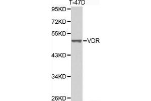 Western blot analysis of extracts of T-47D cell lines, using VDR antibody. (Vitamin D Receptor 抗体  (AA 1-300))